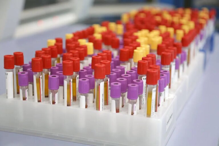 Botulino, Meo (Artemisia Lab) “Attenzione alle conserve fatte in casa”